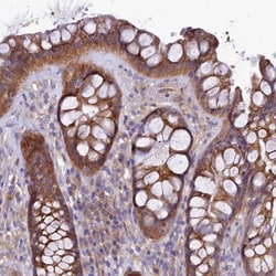 QARS Antibody, Novus Biologicals 0.1mL; Unlabeled:Antibodies, Polyclonal